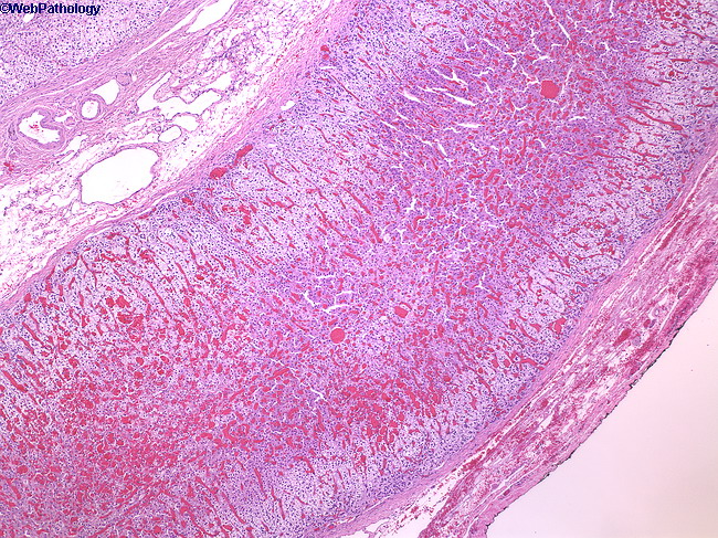 Adrenal_Histology1.jpg