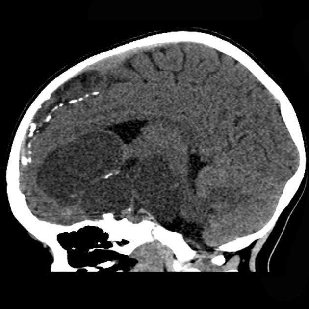 Brain_Craniopharyngioma_Ad_Radiology1.jpg
