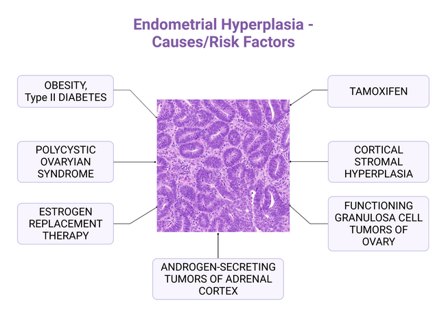 EndometrialHyperplasia_Causes_Illustration_resized.png