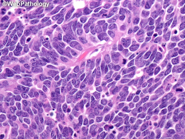 A Collection of Surgical Pathology Images
