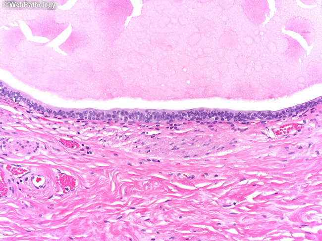 UrinaryBladder_Histology12.jpg