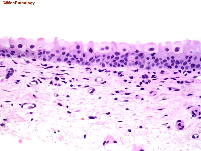 UrinaryBladder_Histology2.jpg