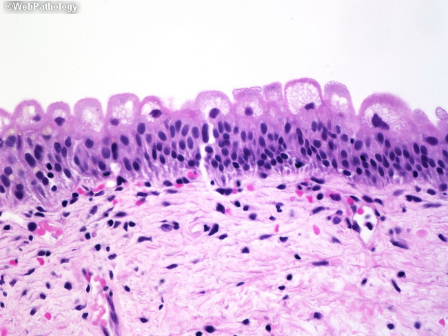 UrinaryBladder_Histology3.jpg