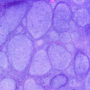 thumbnail image of Lymph Node/Spleen microscope section