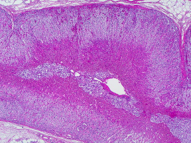 Adrenal Gland Cortex Histology