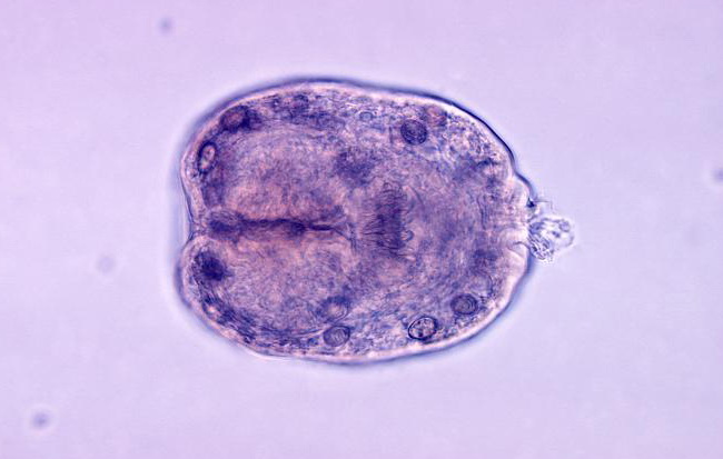 Echinococcus3_resized.jpg