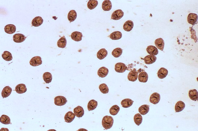 Echinococcus_HydatidSand.jpg