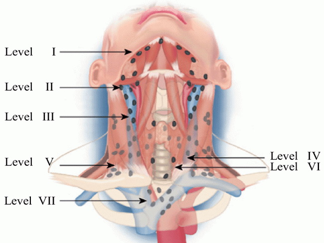 HemePath_Mets_Thyroid_LN_Diagram.jpg