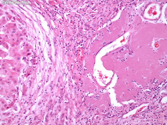  A Collection of Surgical Pathology Images