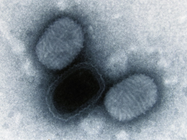 MolluscumContagiosum_Virus1.jpg