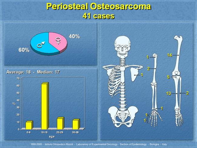 Osteosarcoma7_Periosteal_Resized.jpg