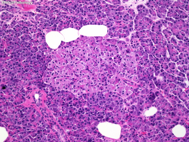 Pancreas_Histology2_IsletCells.jpg