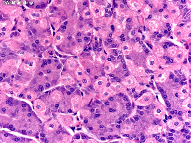 Stomach_Histology_FundicGlands4.jpg