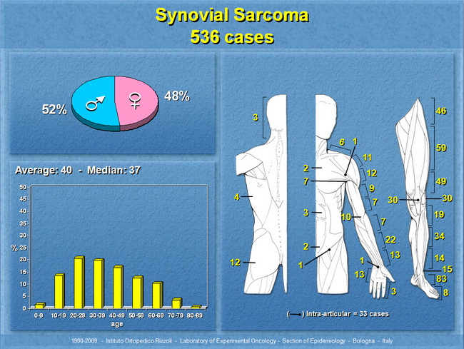 SynovialSarcoma36_resized.jpg