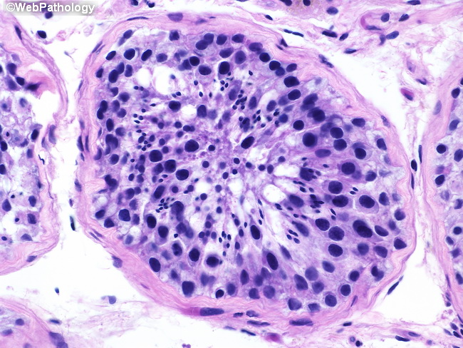 Testes_Histology_Spermatogenesis2(1).jpg