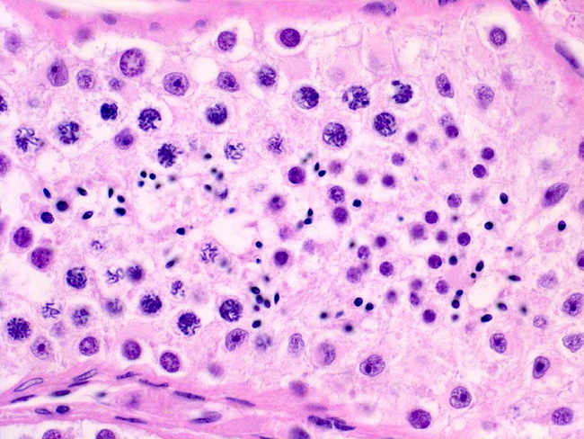 Testes_Histology_Spermatogenesis3.jpg