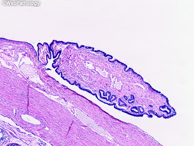 Testis_Histology_AppendixTestis4.jpg