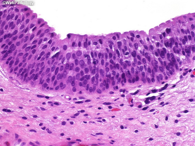 UrinaryBladder_Histology1.jpg
