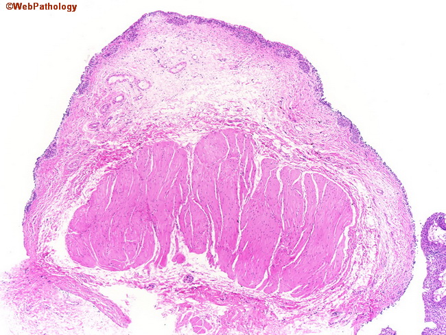UrinaryBladder_Histology10.jpg