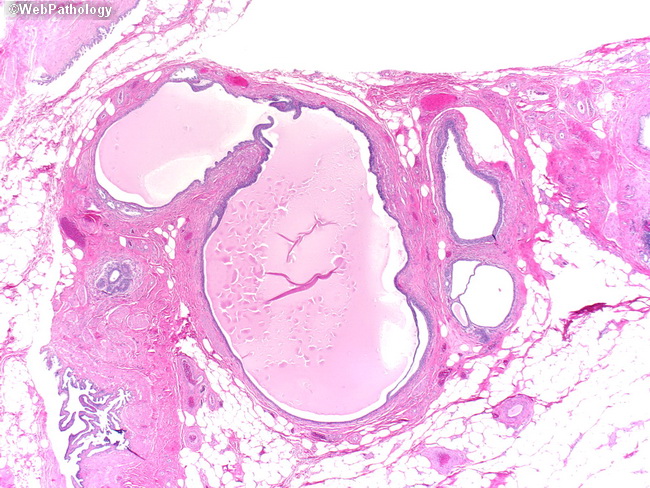 UrinaryBladder_Histology11.jpg