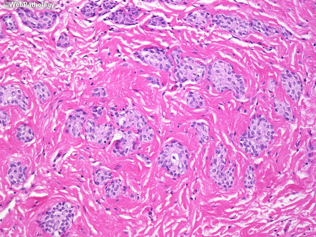 UrinaryBladder_Histology7.jpg