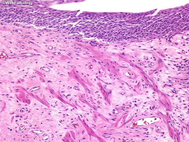 UrinaryBladder_Histology8.jpg