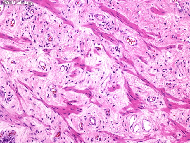 UrinaryBladder_Histology9.jpg