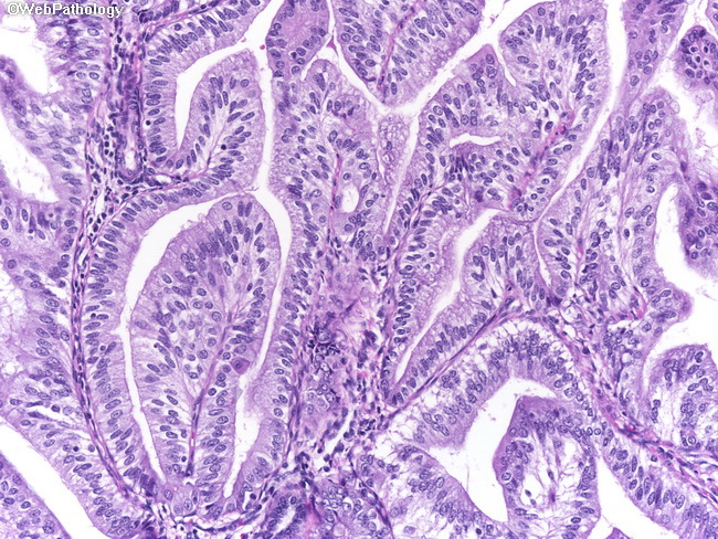 Uterus_Endometrium_MucinousMetaplasia2.jpg